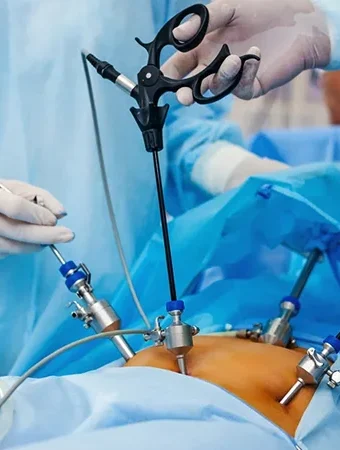 胃バイパス術および右半結腸切除術 における腹腔鏡アノテーション